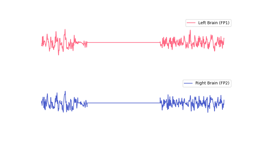 Disturbed Brainwaves